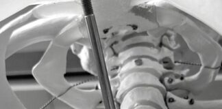 Tag der Rückengesundheit: Rückenschmerzen sind eine Volkskrankheit – moderne Therapien bieten neue Perspektiven